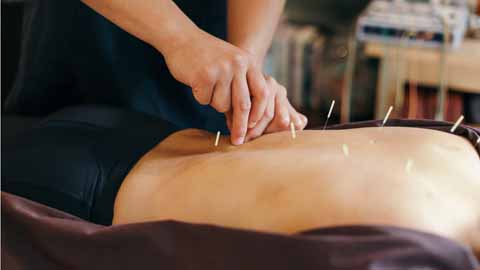 career cluster image of a Acupuncturists job occupation